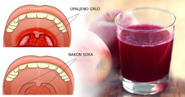 Narodni lek za lečenje bilo koje upale grla – sok od cvekle