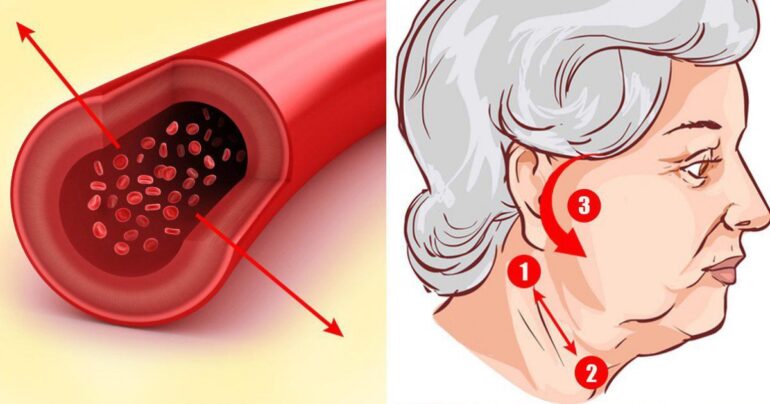 Brzo i efikasno smanjite krvni pritisak, i što je najvažnije – bez tableta