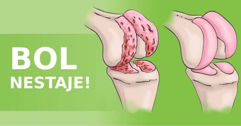 Prirodni lek koji otklanja svaki bol u nogama i zglobovima