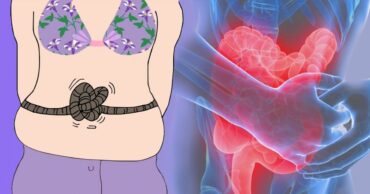 Vratite mikrofloru u creva: 3 fermentisane hrane koje će izlečiti stotine bolesti